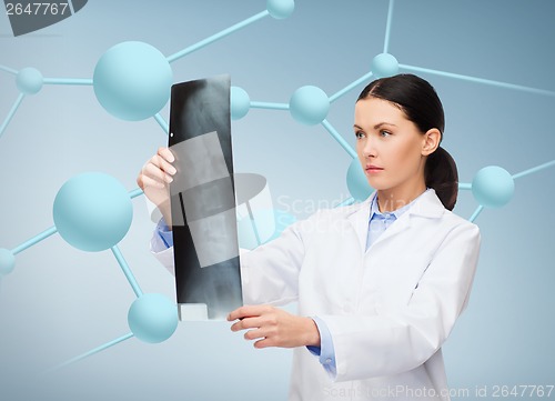 Image of serious female doctor looking at x-ray