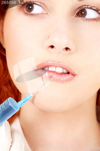 Image of lips enlargement procedure