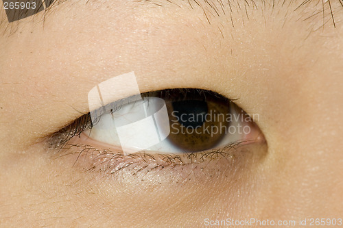 Image of 382 Asian Eye