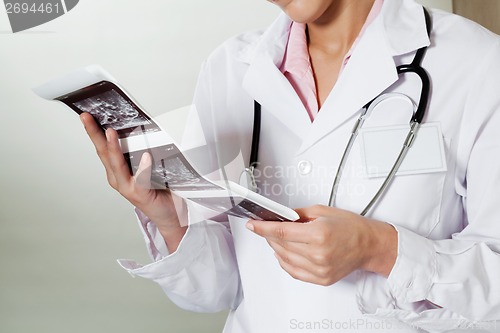 Image of Radiologist Holding Ultrasound Print