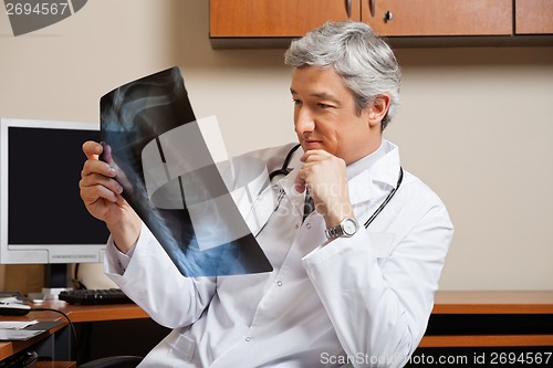 Image of Radiologist Analyzing Shoulder X-ray
