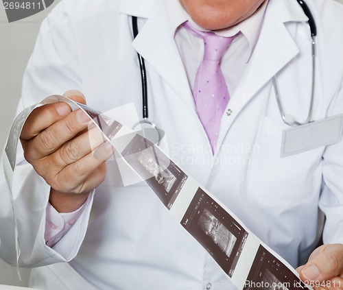 Image of Radiologist Holding Ultrasound Print