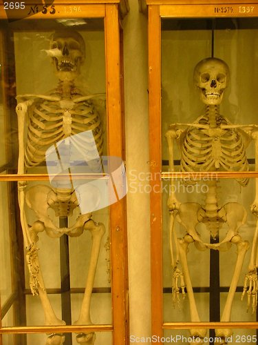 Image of skeletons in a cupboard