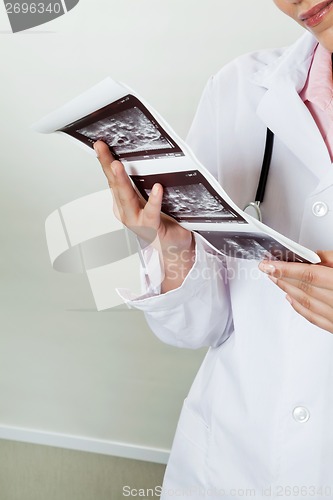 Image of Radiologist Holding Ultrasound Print