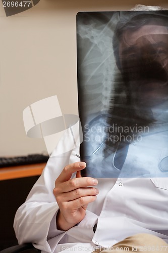 Image of Radiologist Holding X-ray