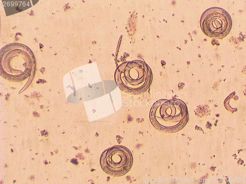 Image of Trichinella spiralis - parasitic worm microscope