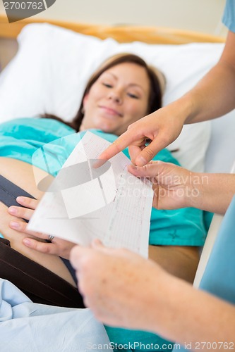 Image of Detail of Fetal Monitor Graph