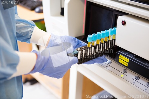 Image of Coagulation Test Analysis