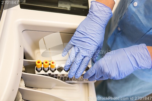 Image of Top View Loading Samples in Chemistry Analyzer