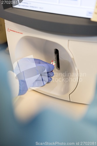 Image of Blood Gas Analysis