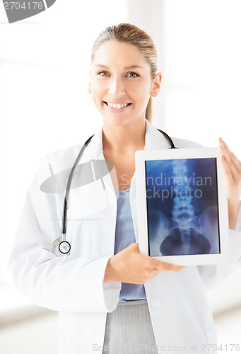 Image of female doctor with x-ray on tablet pc