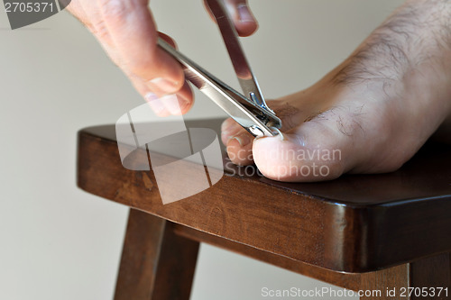 Image of Clipping Toenails