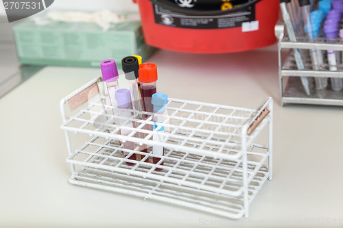 Image of Test Tubes With Blood Samples