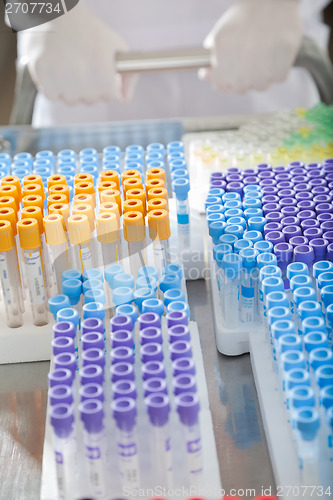 Image of Test Tubes On Medical Trolley