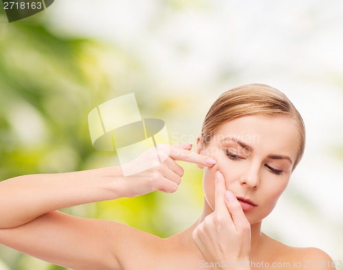 Image of young woman squeezing acne spots