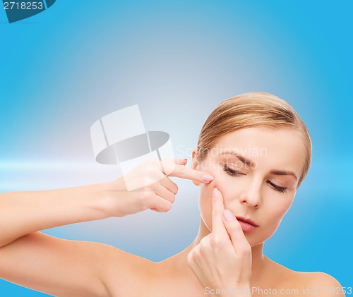 Image of young woman squeezing acne spots