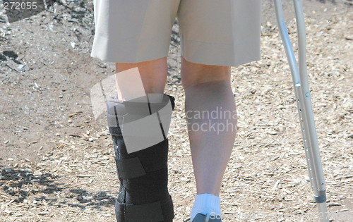 Image of Broken Leg