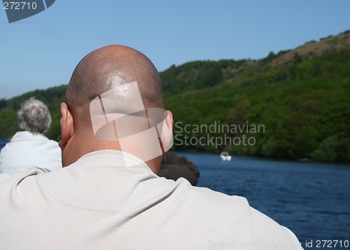 Image of bald head