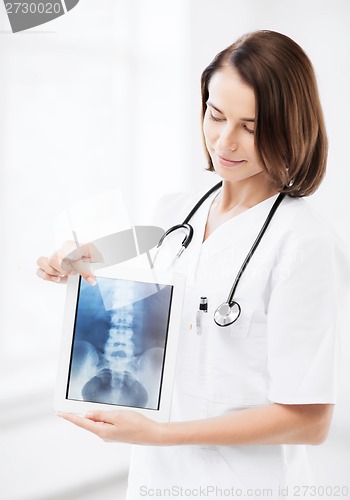 Image of female doctor with x-ray on tablet pc