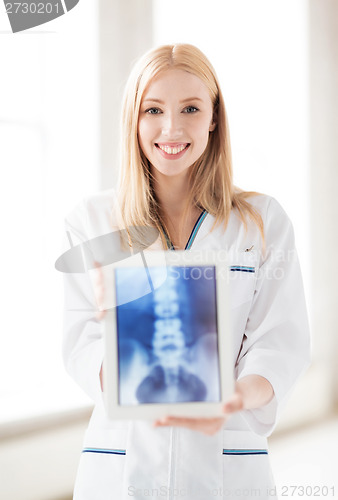 Image of female doctor with x-ray on tablet pc