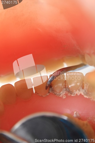 Image of detail of dental problem 