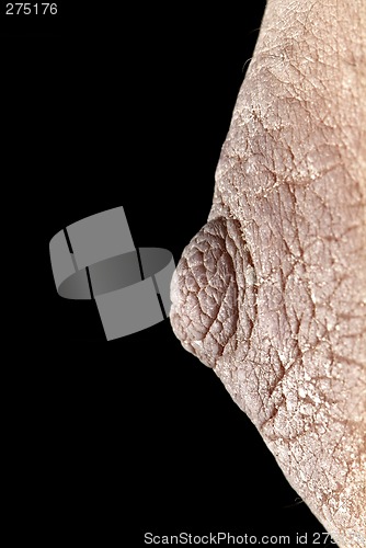 Image of white bosom