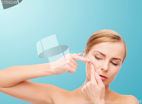 Image of young woman squeezing acne spots
