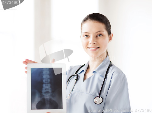 Image of female doctor with x-ray on tablet pc