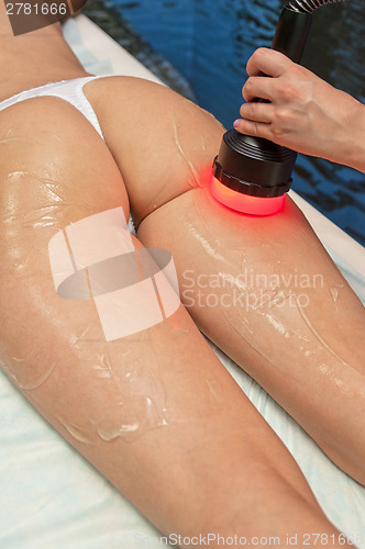 Image of procedure