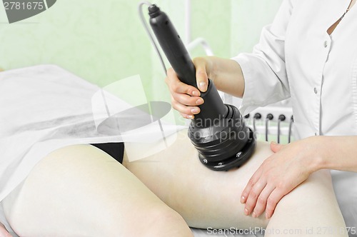 Image of procedure
