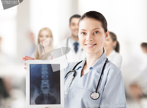 Image of female doctor with x-ray on tablet pc