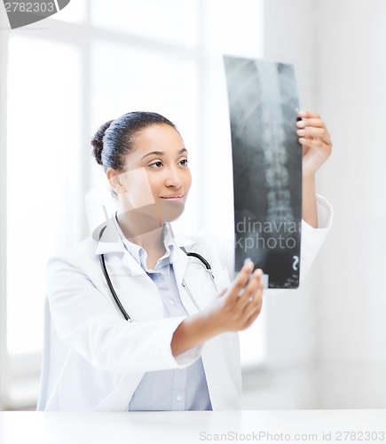 Image of african doctor looking at x-ray