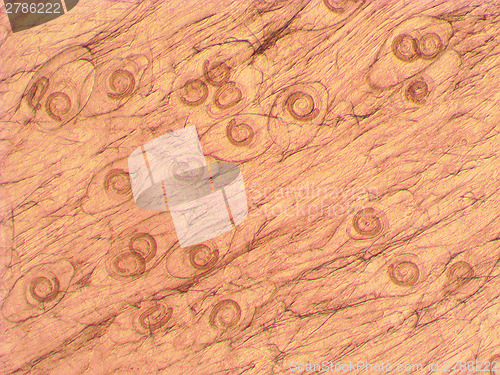 Image of Trichinella spiralis - parasitic worm microscope