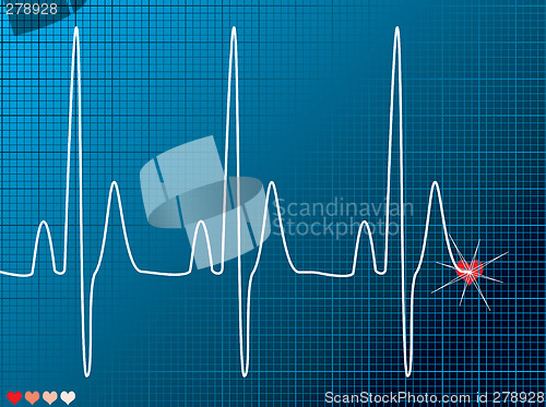 Image of heart beat medical dark