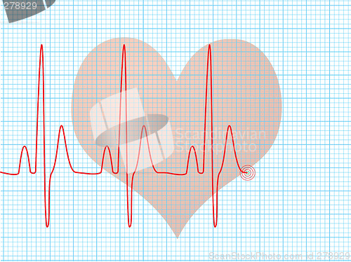 Image of heart beat medical