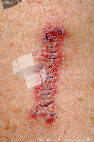 Image of Stitches