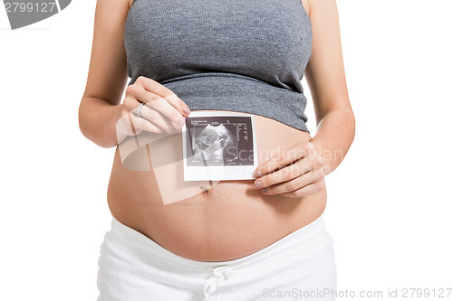 Image of Pregnant woman displaying a prenatal ultrasound