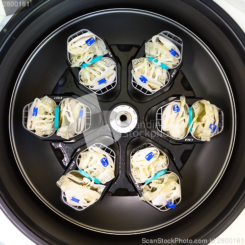 Image of Separation of serum and blood cells in centrifuge.