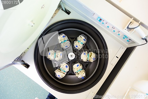 Image of Separation of serum and blood cells in centrifuge.