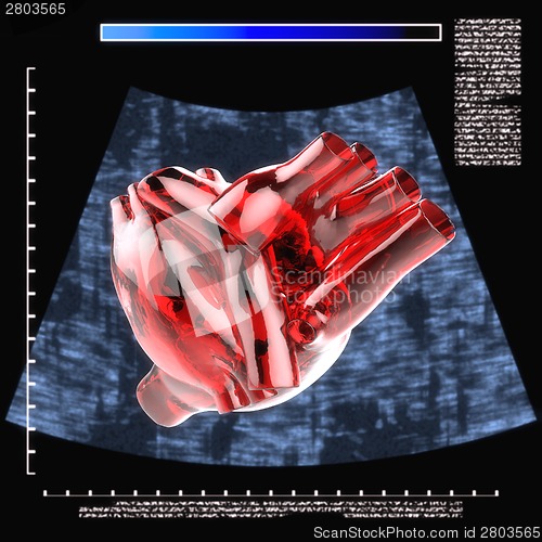 Image of Model of artificial human heart