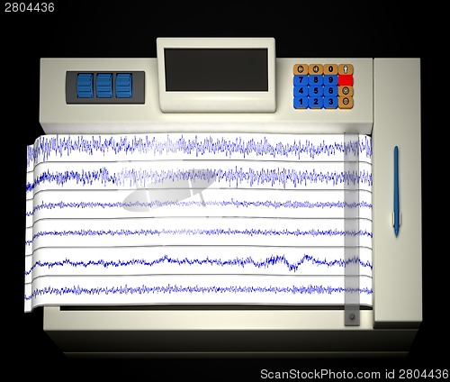 Image of encephalogram