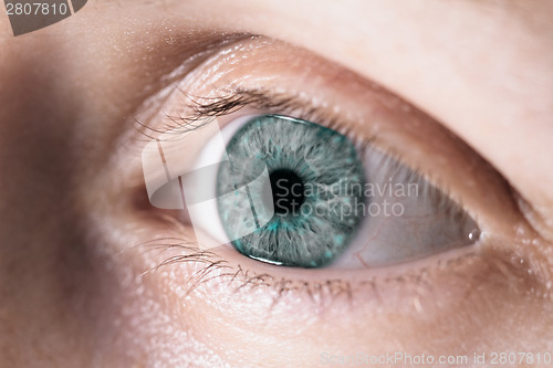 Image of Female eye