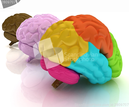 Image of Human brains