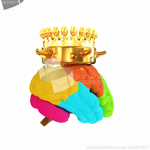Image of Gold Crown on the brain