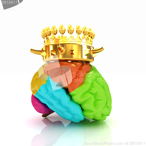 Image of Gold Crown on the brain