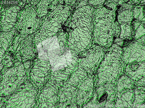 Image of Light micrograph