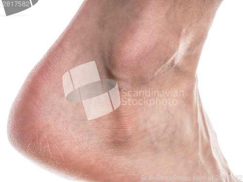 Image of Male ankle