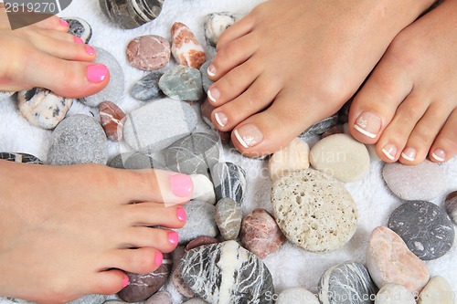 Image of womens legs (nails) and stones (pedicure)