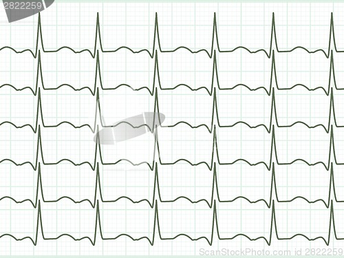 Image of Heart cardiogram. EPS 8