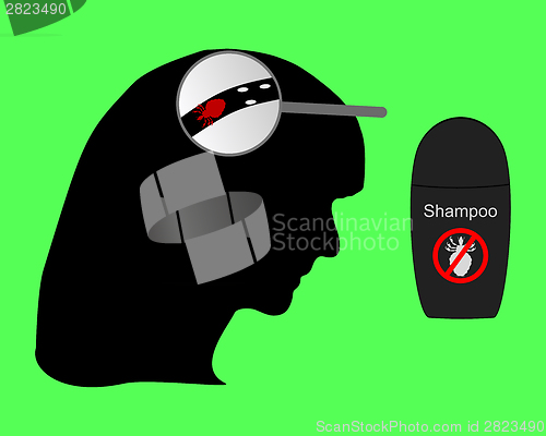 Image of Head of woman, louse, nit and lice shampoo